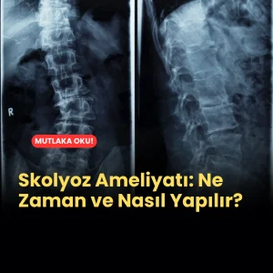 skolyoz ameliyatı, ne zaman ve nasıl yapılır?