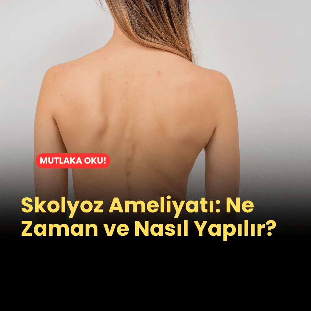 skolyoz ameliyatı ne zaman ve nasıl yapılır?