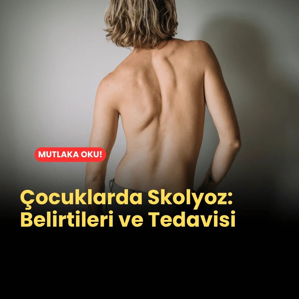 Çocuklarda Skolyoz: Belirtileri ve Tedavisi 1 Çocuklarda Skolyoz Belirtileri ve Tedavisi