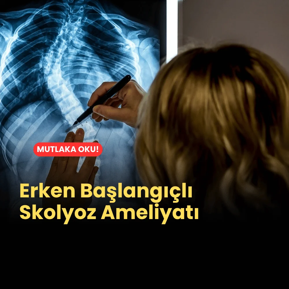 Erken Başlangıçlı Skolyoz Ameliyatı 1 Erken Başlangıçlı Skolyoz Ameliyatı Ne