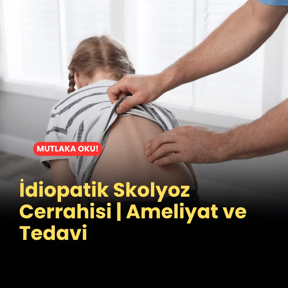İdiopatik Skolyoz Cerrahisi | Ameliyat ve Tedavi 1 İdiopatik Skolyoz Cerrahisi | Ameliyat ve Tedavi Ne
