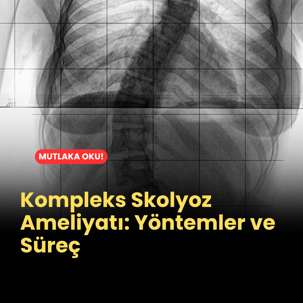 Kompleks Skolyoz Ameliyatı: Yöntemler ve Süreç 1 Kompleks Skolyoz Ameliyatı, Yöntemler ve Süreç