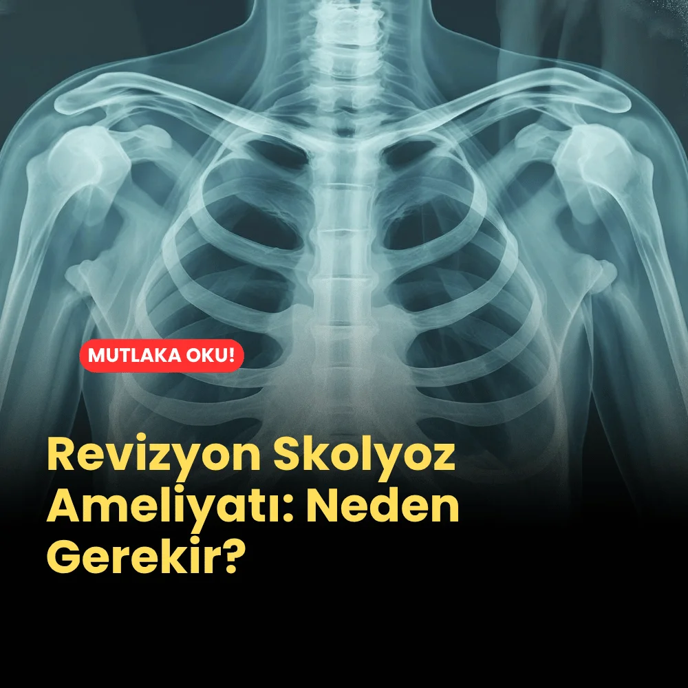 Revizyon Skolyoz Ameliyatı: Neden Gerekir? 1 Revizyon Skolyoz Ameliyatı, Neden Gerekir?